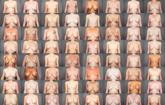 women's breast
