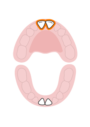 illustration of the central incisor eruption for babies