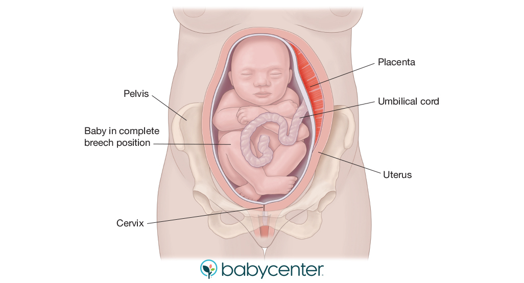 diagram of breech baby, facing head-up in uterus