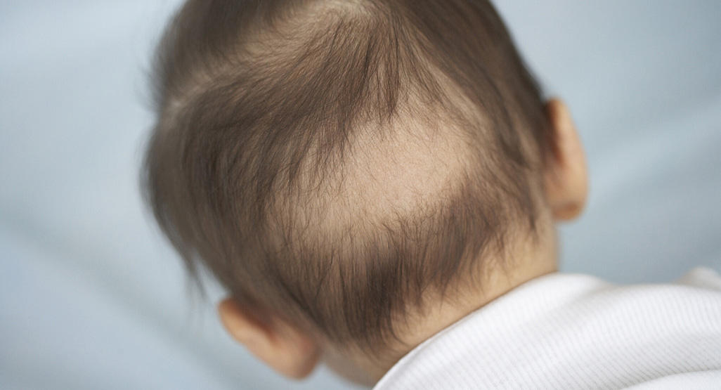 back of a baby's head with a bold spot