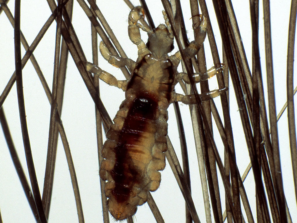 close-up of lice with six legs, long torso, and two antennae