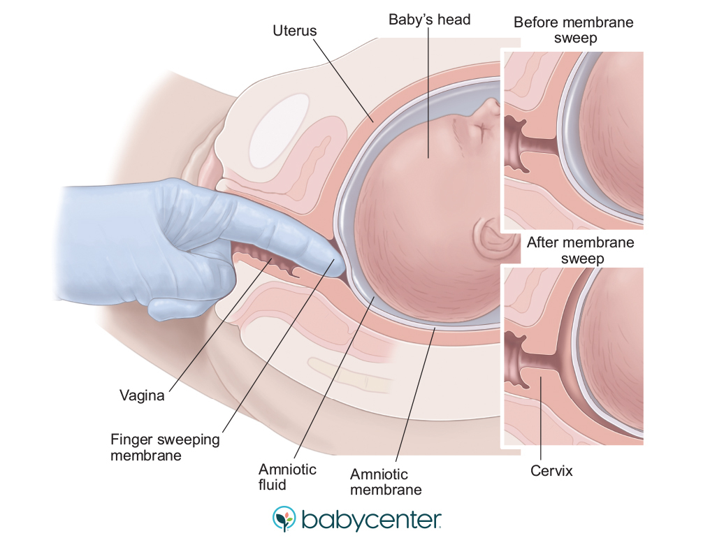 diagram of finger inserted through the cervix