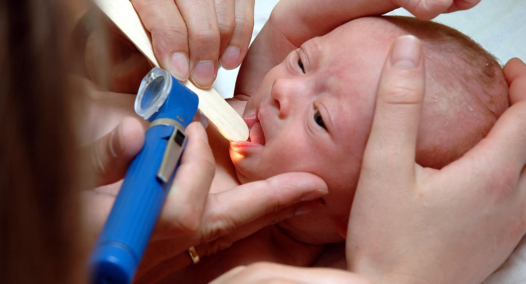 doctors examining baby's throat