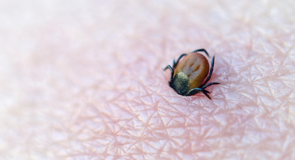 tick attached to the skin
