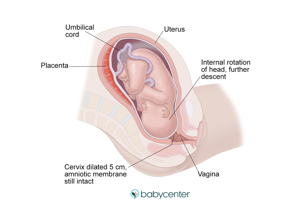 medical illustration showing cervix dilating