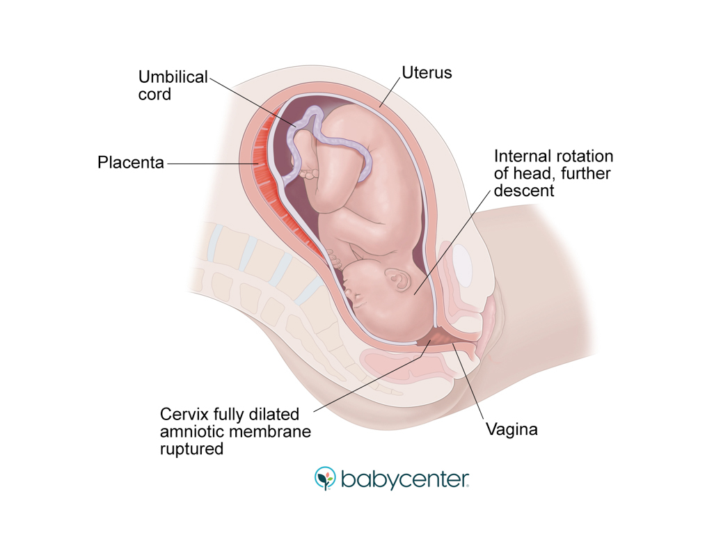medical illustration showing cervix dilated