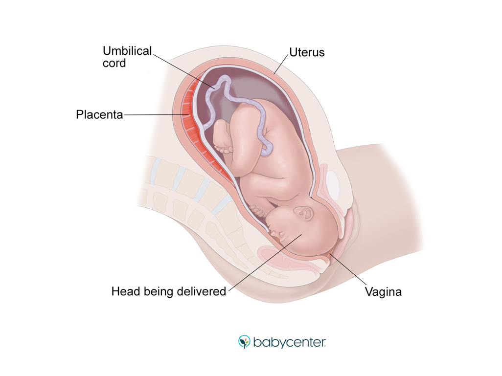 medical illustration showing baby