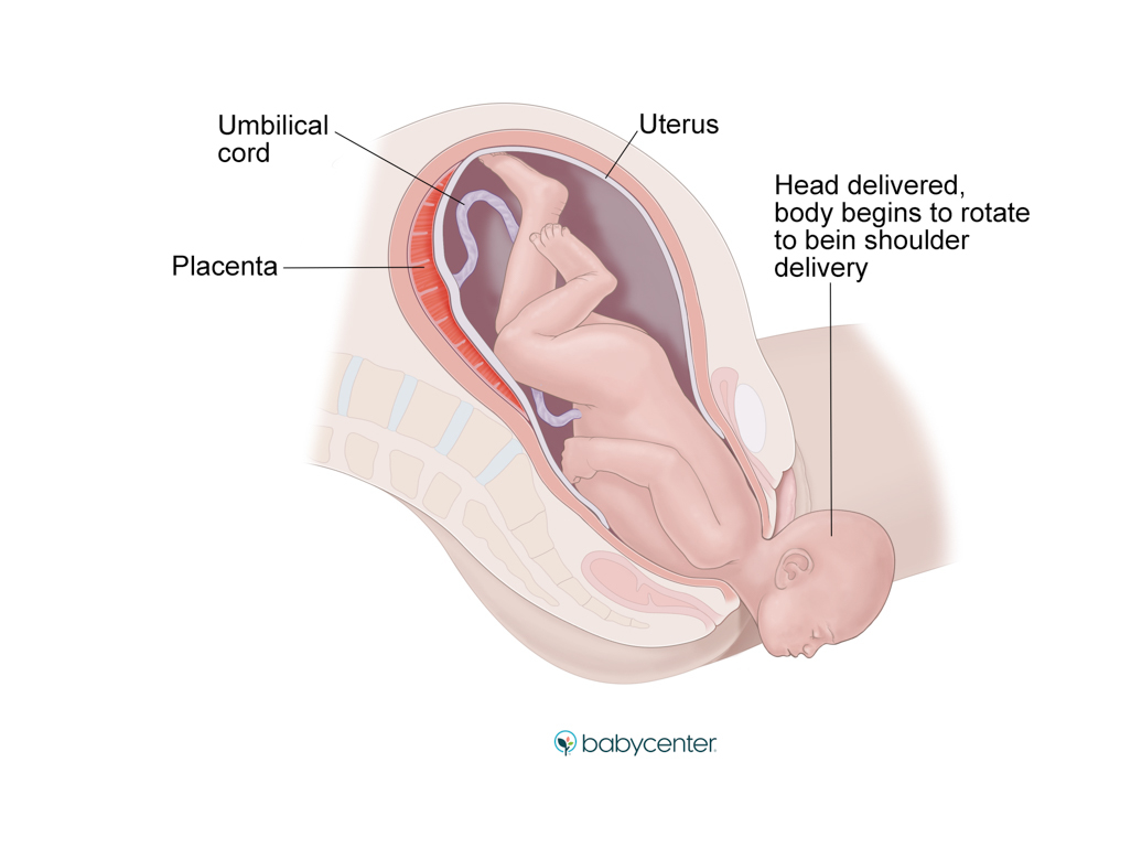 medical illustration showing baby