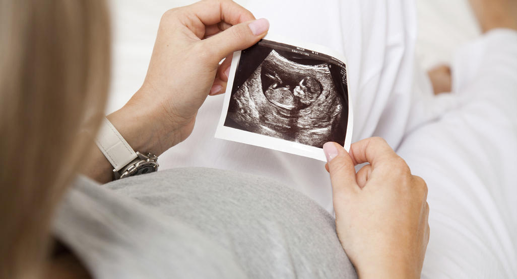 woman looking at an ultrasound photo