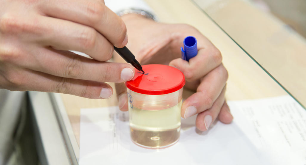 doctor marking urine sample bottle with a marker