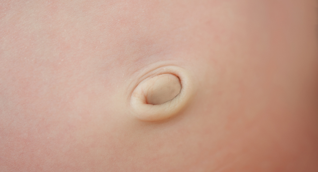 Infant's belly button